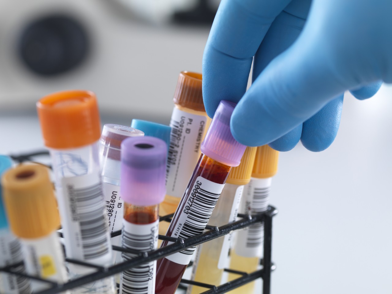 “溶出”还是“BE”，何为临床疗效“金尺度”