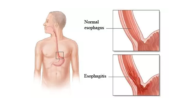 首页| PP电子游戏中国区官方网站