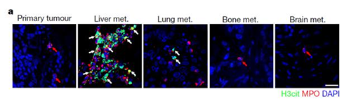 转入幼鼠模型得到一样的试验了局，且在转移产生前NET已在肝脏聚积。