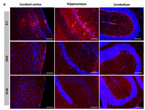 被包裹在含有NT-类脂质的LNP中的Cre沉组酶成功转移。大脑中的转染神经元呈红色高亮。