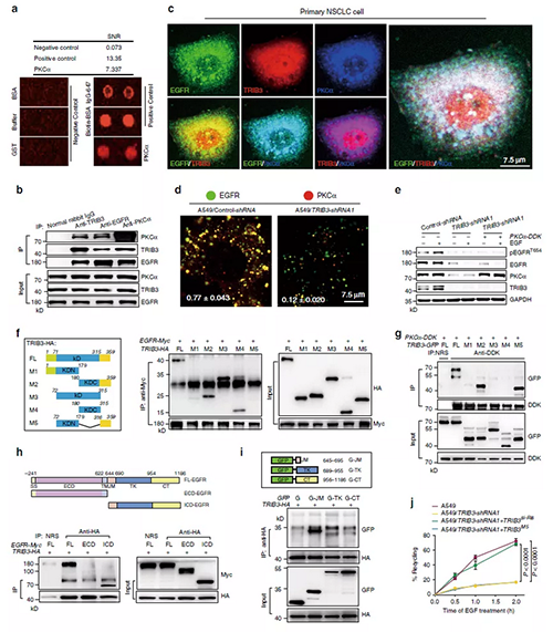 TRIB3与EGFR相互作用以推进PKCα介导的EGFR磷酸化