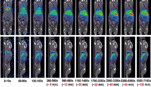 PP电子游戏PET/CT分子影像技术平台