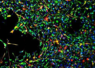 世界初创：药物将干细胞疏导至受损部位，提高其愈合能力！