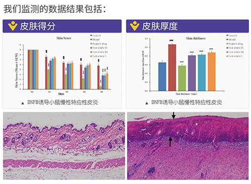 PP电子游戏成立的特应性皮炎及湿疹模型监测数据了局