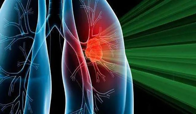 盛世泰科1类创新药物CGT-9475实现中美双报双批 | PP电子游戏一站式临床前生物医药研发服务平台助力