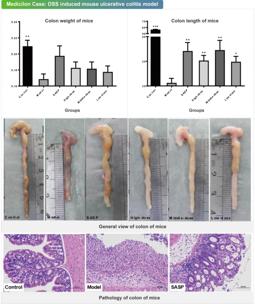 11 葡聚糖硫酸钠诱导的幼鼠溃疡性结肠炎模型.jpg
